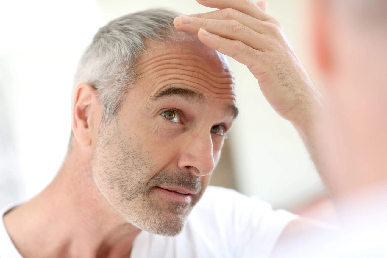 When to Consult Hair Loss Expert