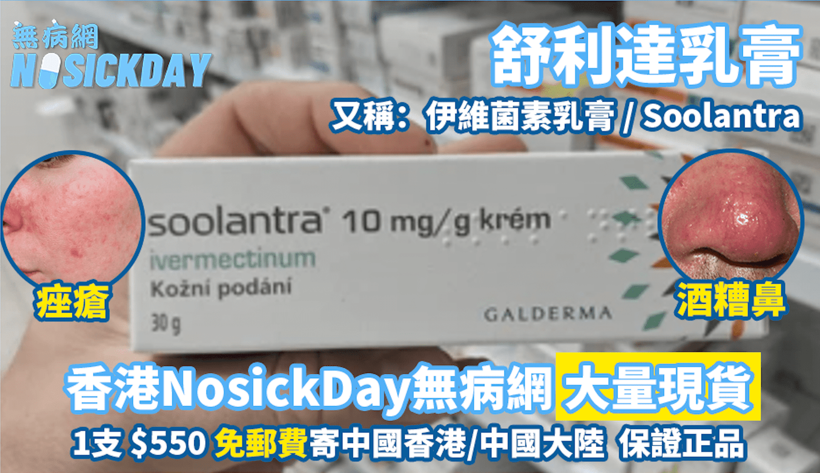 nosicnday-舒利達乳膏-蠕形蟎蟲_痤瘡